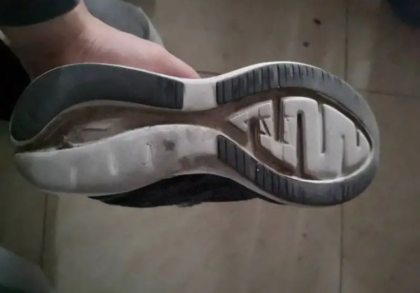 孩子足外翻怎样辨别,小孩子足外翻矫正鞋底