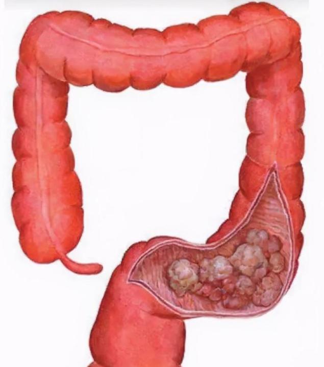 洗肛门会产生什么影响,每次都清洗肛门有何作用