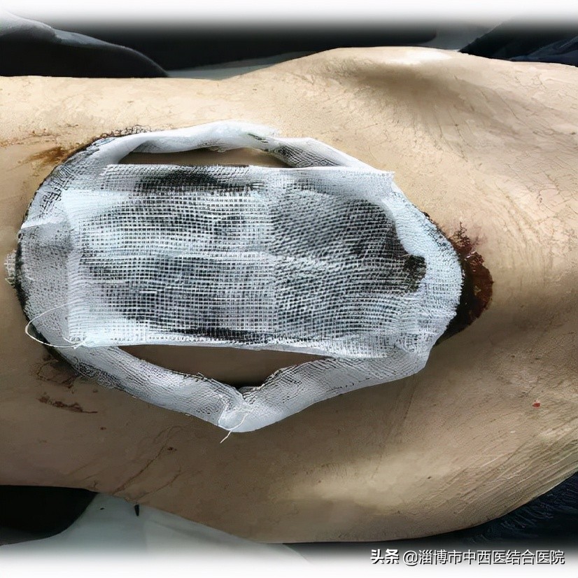 澶撮泚寮曢,澶撮泚棰嗚窇