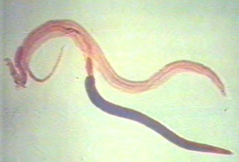 “蛊”究竟是什么？1958年我国蛊病泛滥成灾，毛主席亲自部署