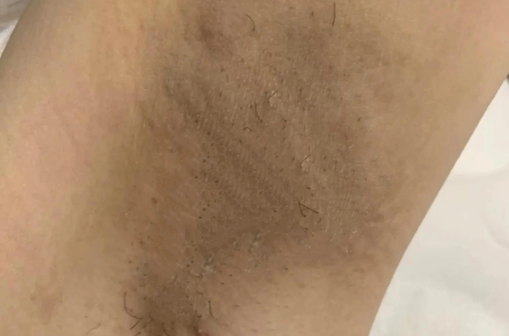 什么止汗露效果好不会黑,口碑最好十大止汗露