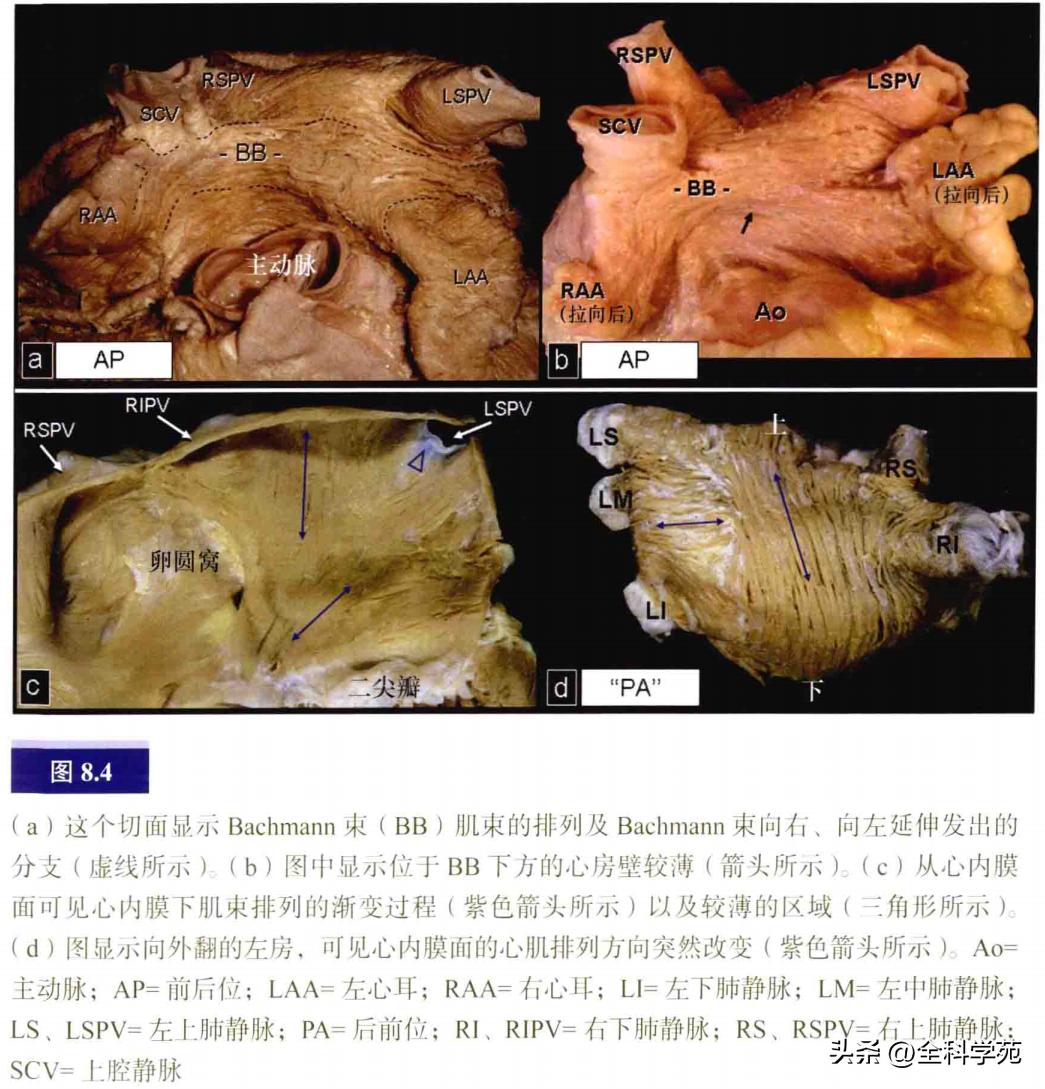 连接左心房的是肺静脉吗,左心房与肺静脉解剖