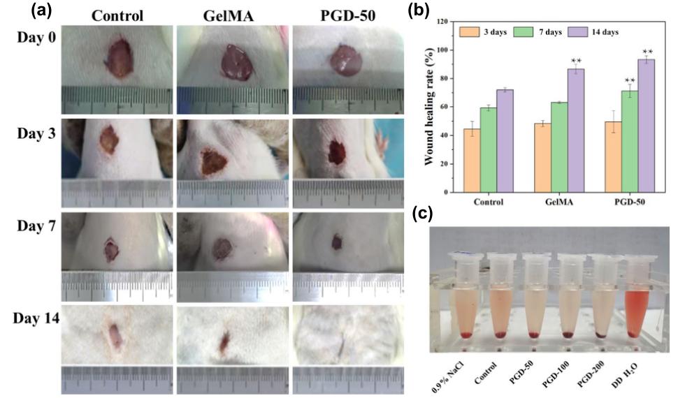 「科研快报」PCL纤维/GelMA水凝胶敷料用于糖尿病伤抗菌和愈合
