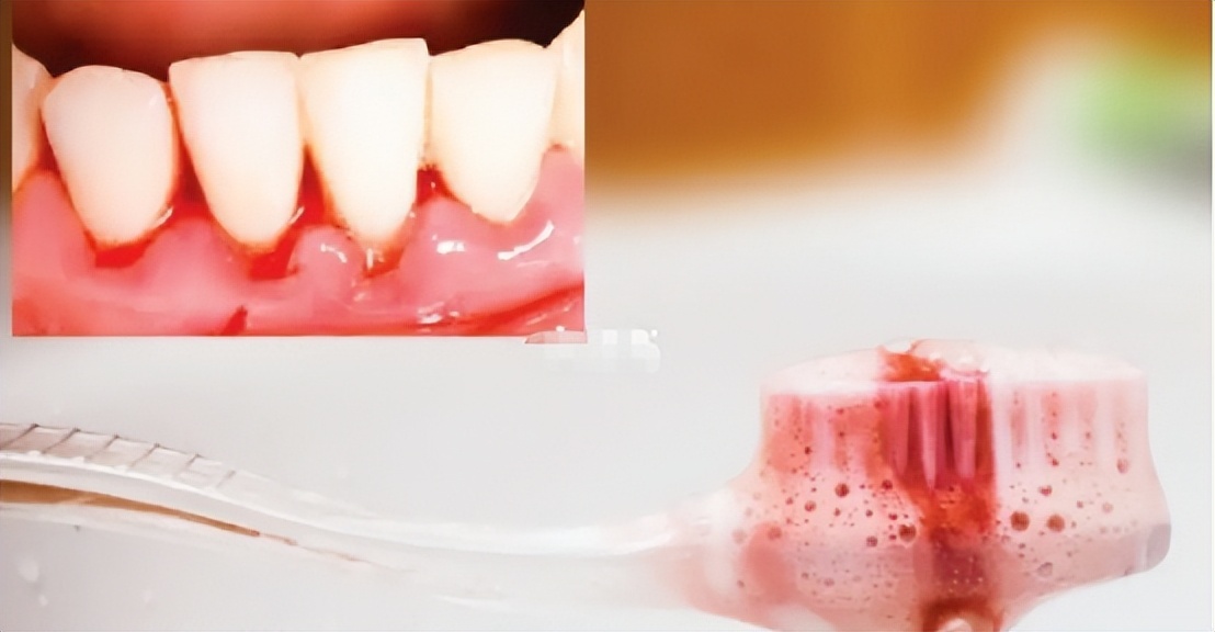 儿童电动牙刷推荐前十名,儿童电动牙刷u型哪款好