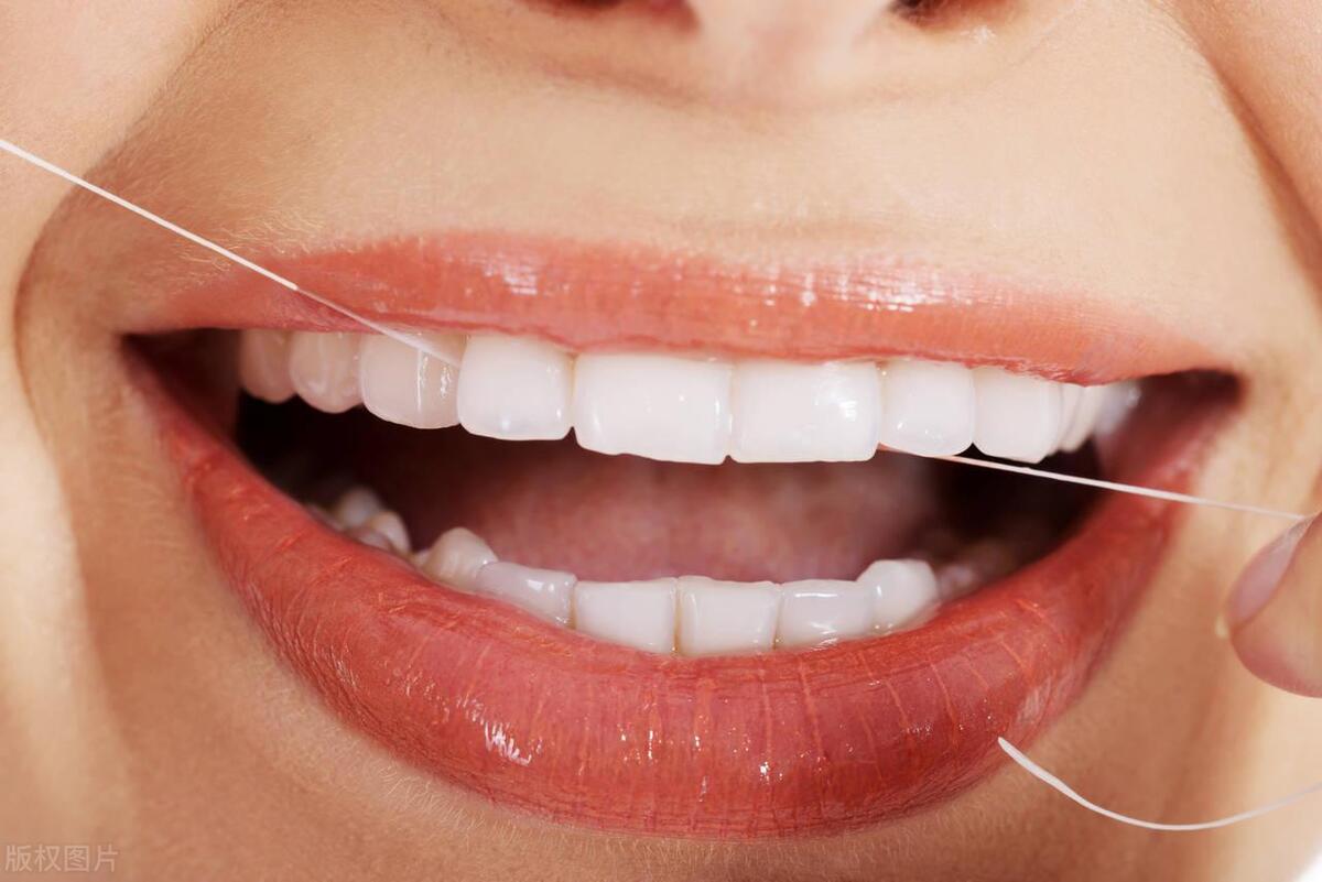 去除牙菌斑最有效的方法,牙菌斑的最有效去除方法