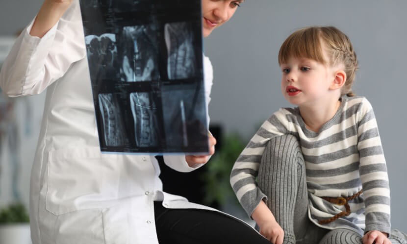 脊椎侧弯怎么办？脊椎侧弯必须要开刀？