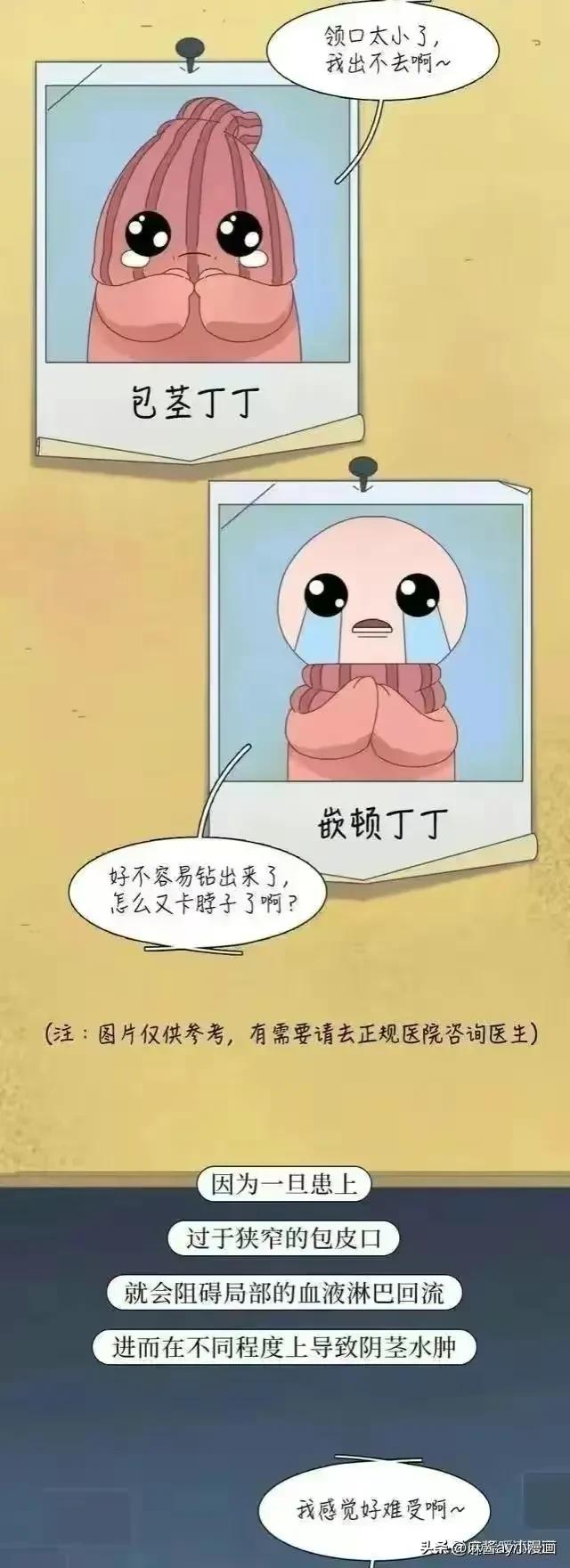 男生割完包皮,割完包皮后变化