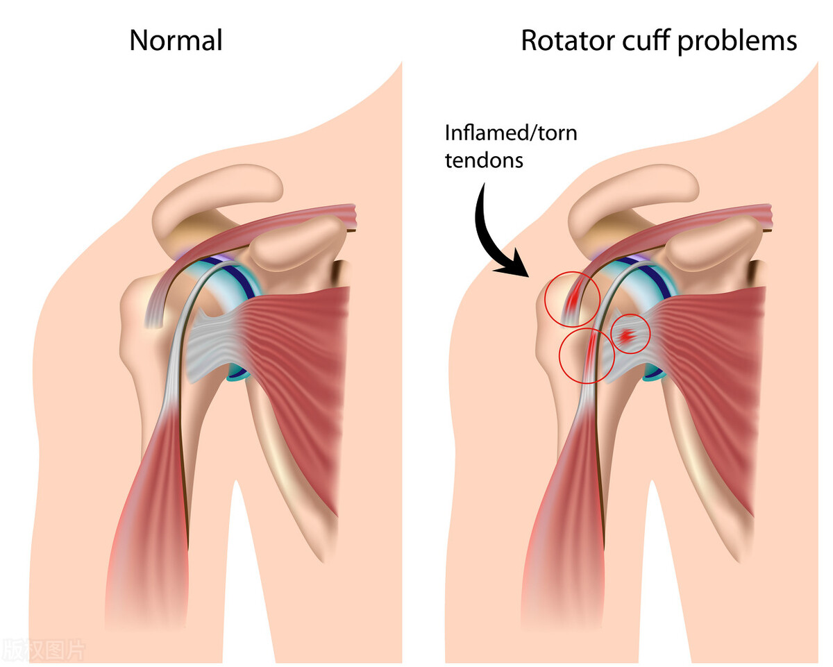 打篮球致人意外受伤要负责吗,打篮球头部被撞双手无力伴随刺痛