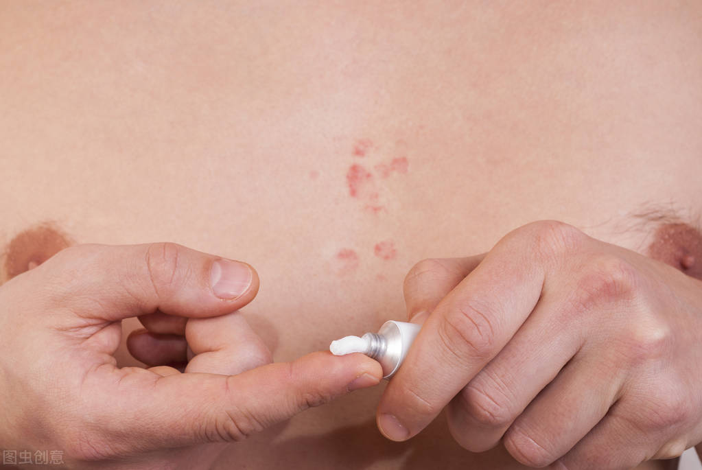 特应性皮炎有“达标治疗”？皮肤科专家首次提出核心内涵