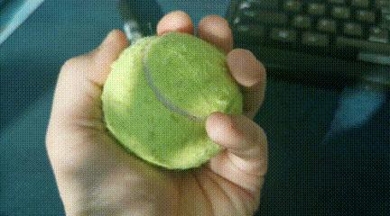 中年妇女手指腱鞘炎是怎么回事,更年期脚拇指腱鞘炎