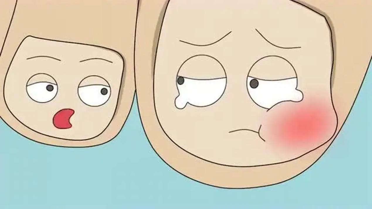 脚趾甲老往肉里钻，一碰还疼？教你小妙招，预防甲沟炎告别疼痛