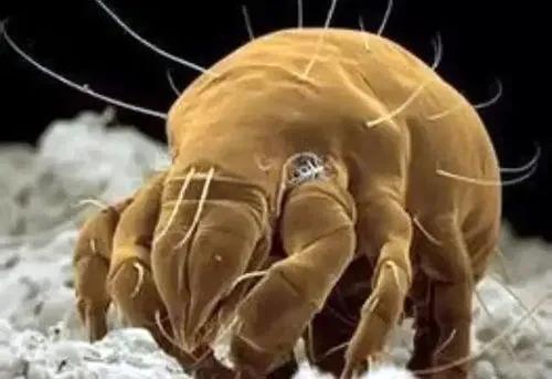 虫咬性皮炎的防治方法有哪些,去除顽固性虫咬皮炎的简单方法