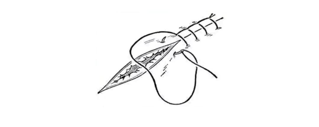 外科各种缝合方法的适用情况,外科操作缝合