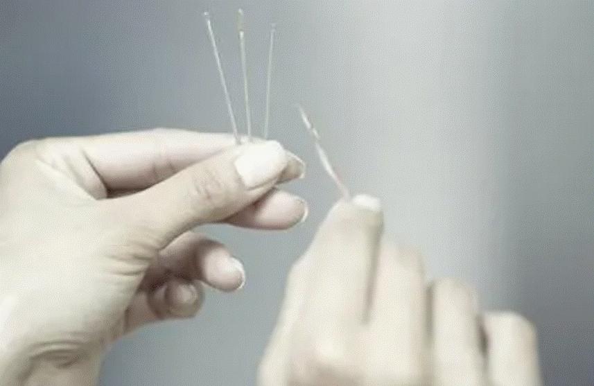 山西3针治疗精神分裂症,催眠术治精神分裂症