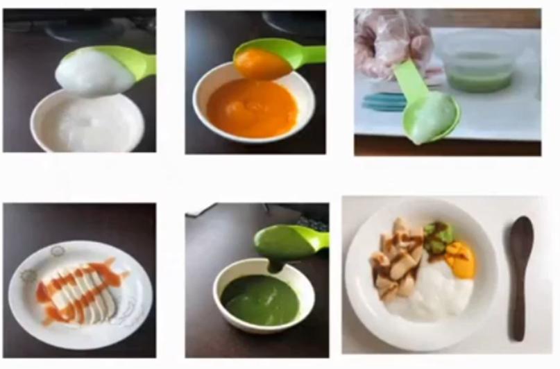 吞咽障碍不能吞咽怎么办,难言之隐吞咽障碍