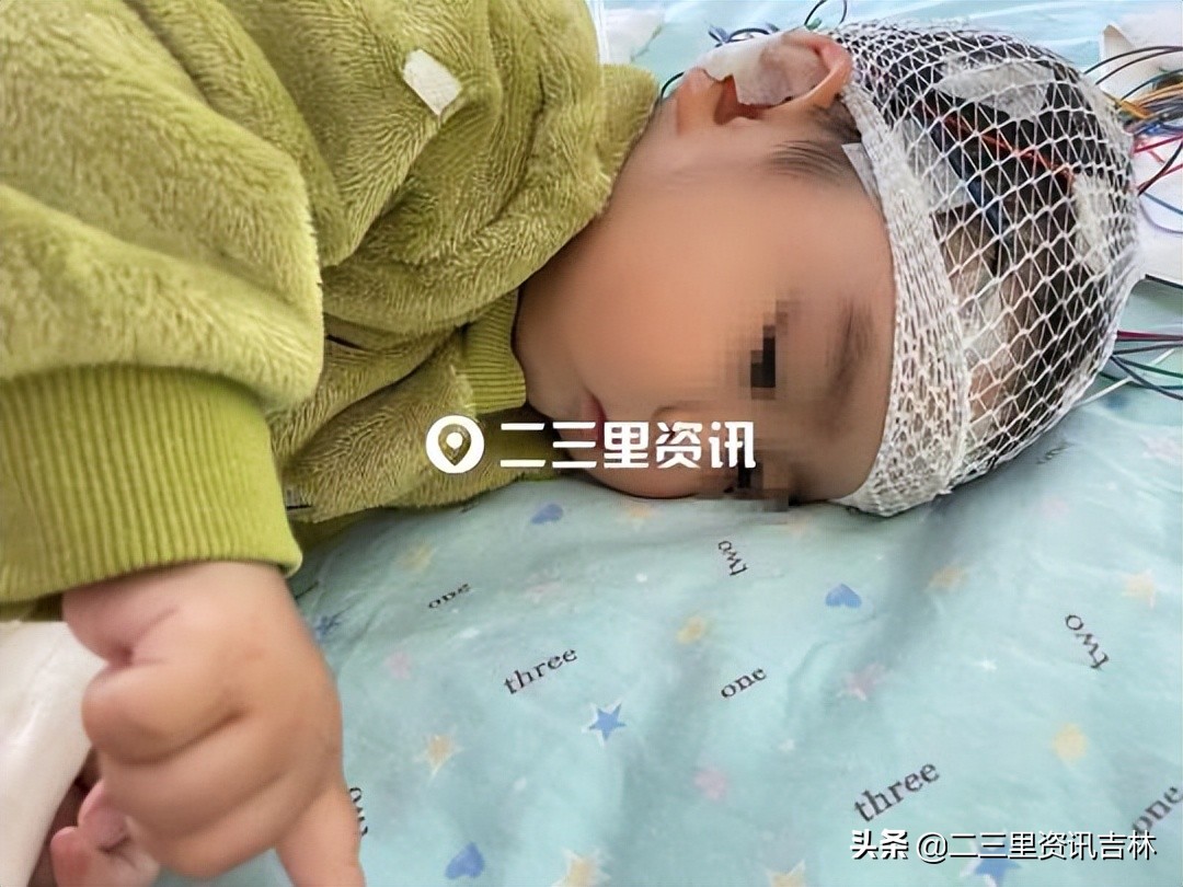 被蜱虫叮咬儿童急救,孩子被蜱虫咬会得脑膜炎吗