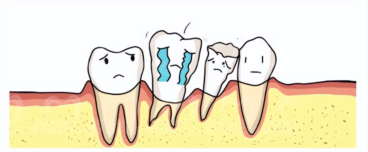 吃东西老是塞牙缝怎么解决,吃东西经常塞牙齿