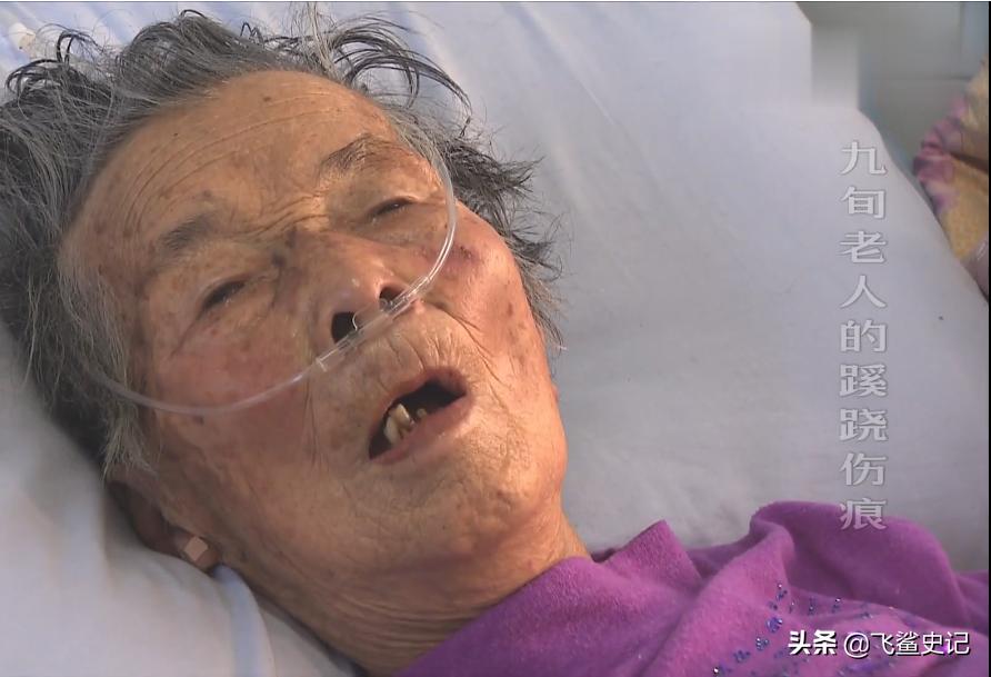 母亲被火灾烧伤,母亲被火烧死后续