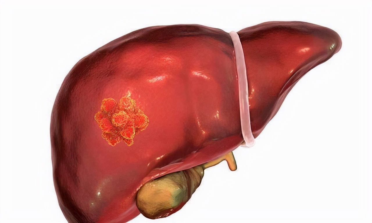 乙肝患者出现什么症状得注意,乙肝患者需要引起重视的情况