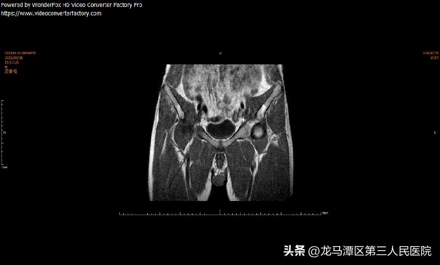 【专家讲堂】区三人医郝琦副教授受邀中国中西结合学会国家继续教育项目