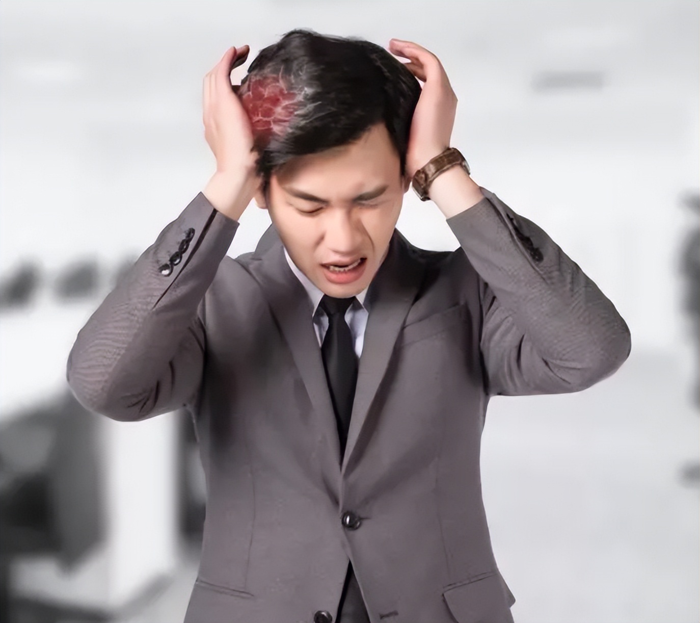 有脑梗前兆如何预防脑梗发生,脑梗会出现什么症状怎样预防脑梗