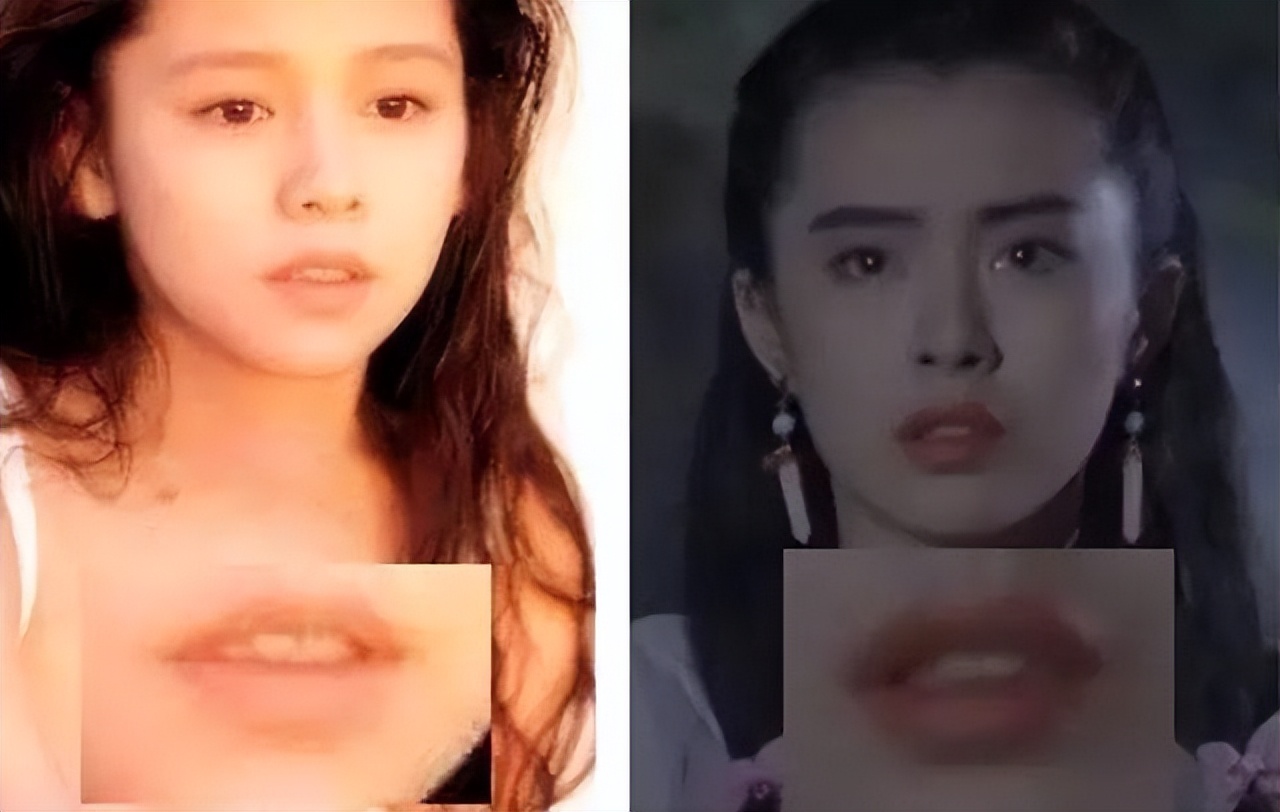 比法令纹更靠上的纹,嘴凸有法令纹改善对比