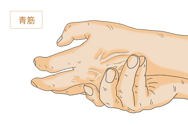为什么站着手臂青筋暴起,为什么有些人手臂上青筋暴露