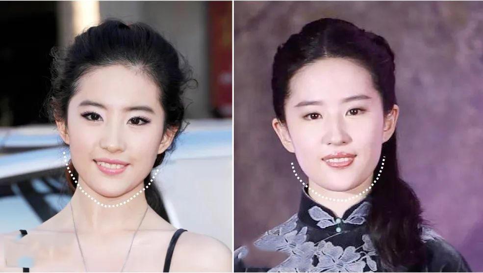 发腮和塌腮哪个更显老,发腮真的显老吗