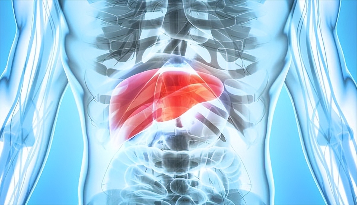 肝硬化男子肚子肿大,患者男性45岁肝硬化腹水10余年