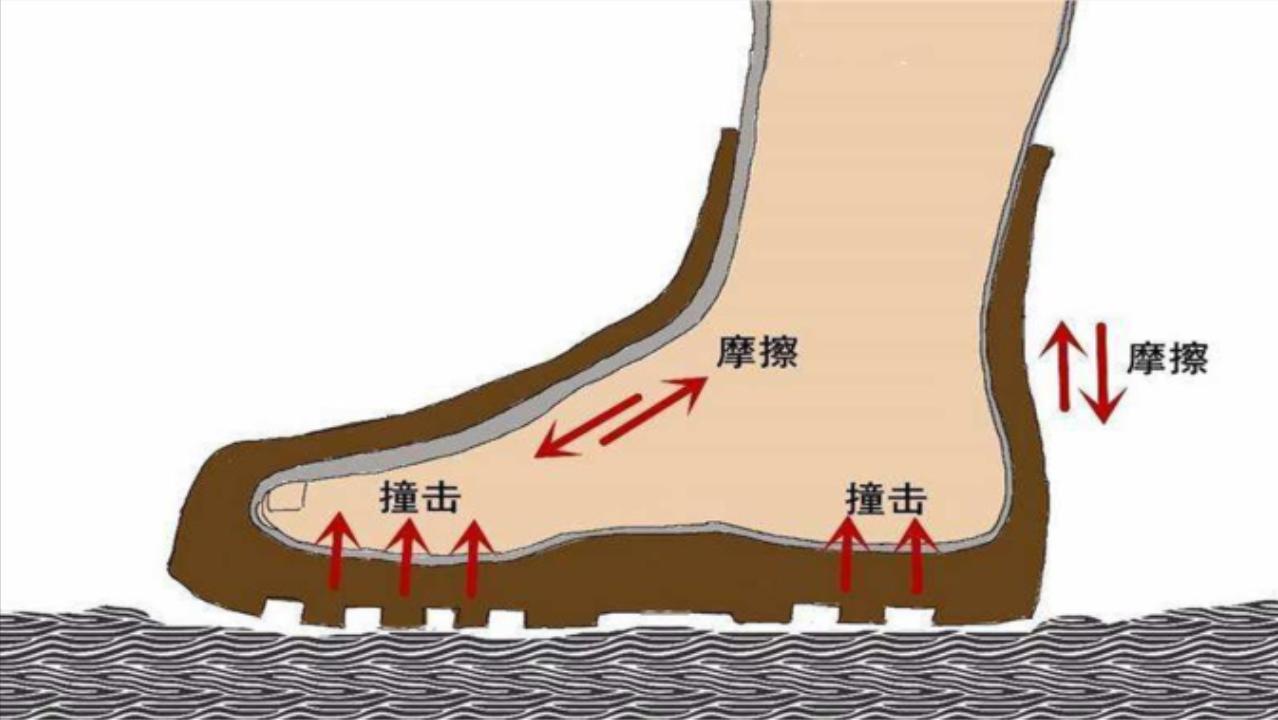 脚底板爱发烫是什么原因,脚底板生茧很疼怎么回事