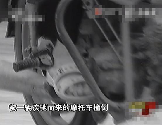 花季少女意外车祸后长胡子,14岁妙龄少女车祸后长胡子