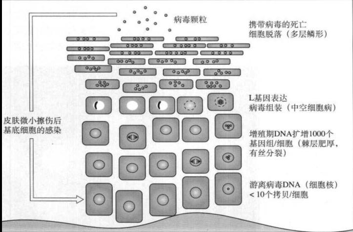 手足疣痊愈过程,跖疣治疗经验分享