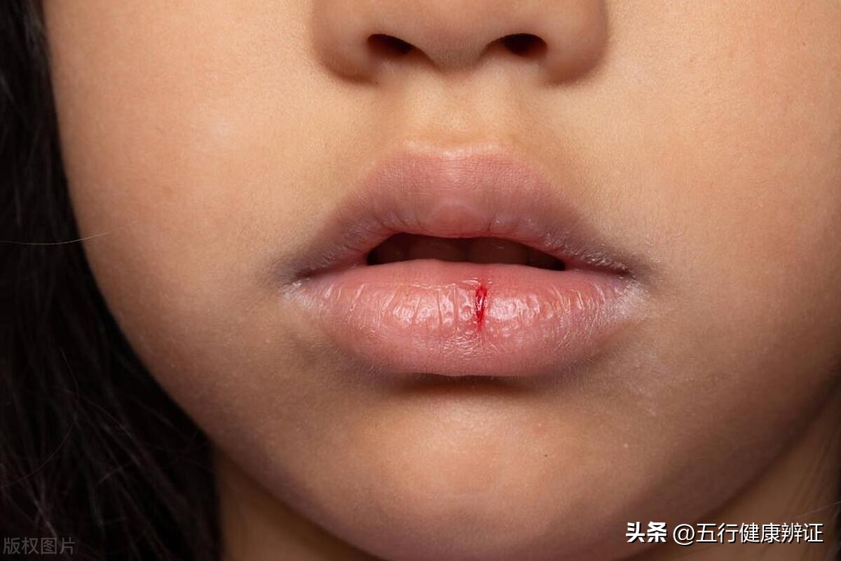 足跟痛原来是肾虚在捣鬼,肾阴虚导致足跟痛怎么治疗