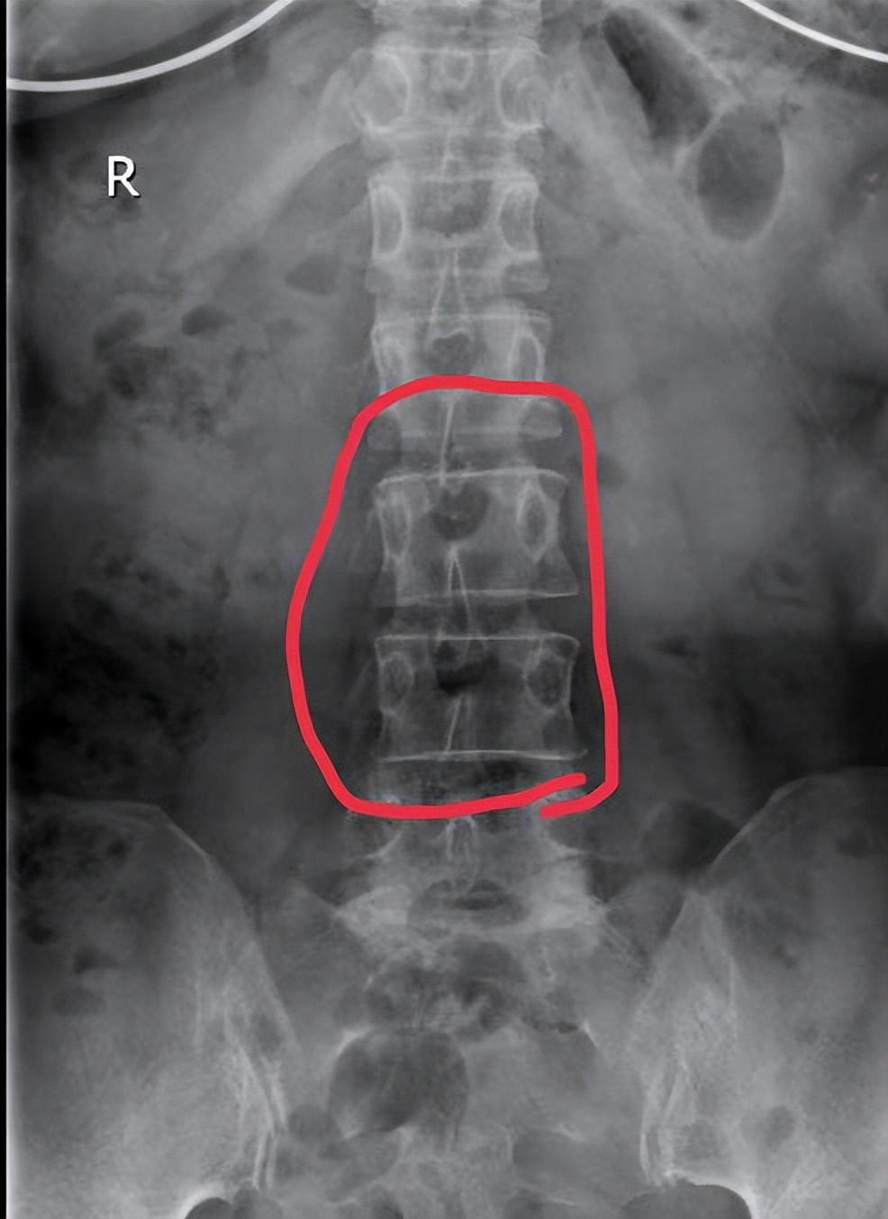 抢菜抢不到该怎么活,抢菜抢米啥都抢该怎么办