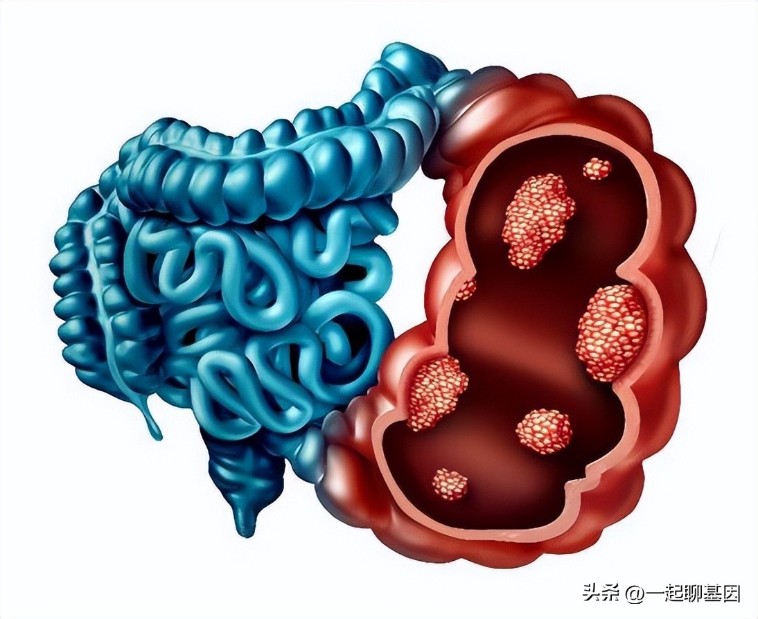 如何在公共场合防止放屁,如何在公众场合阻止放屁