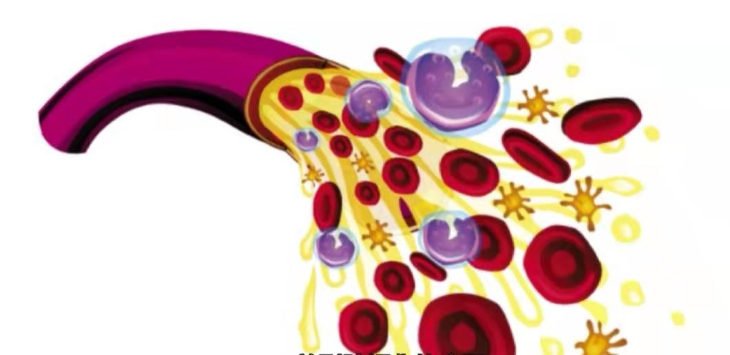 男人前列腺钙化怎么回事,前列腺钙化对男人有什么影响