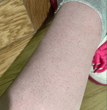 最顶级脱毛神器,无痛脱毛神器测评