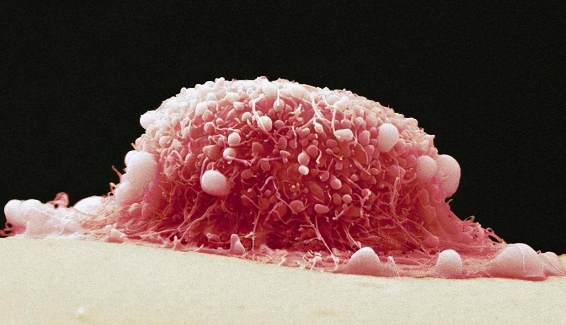 女性没了子宫，会影响“行事”？医生坦言：满意度反而提高了