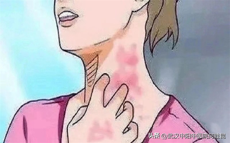 身上腰部起红疙瘩越挠越痒还扩散,孕31周身上痒一挠起红疙瘩很痒