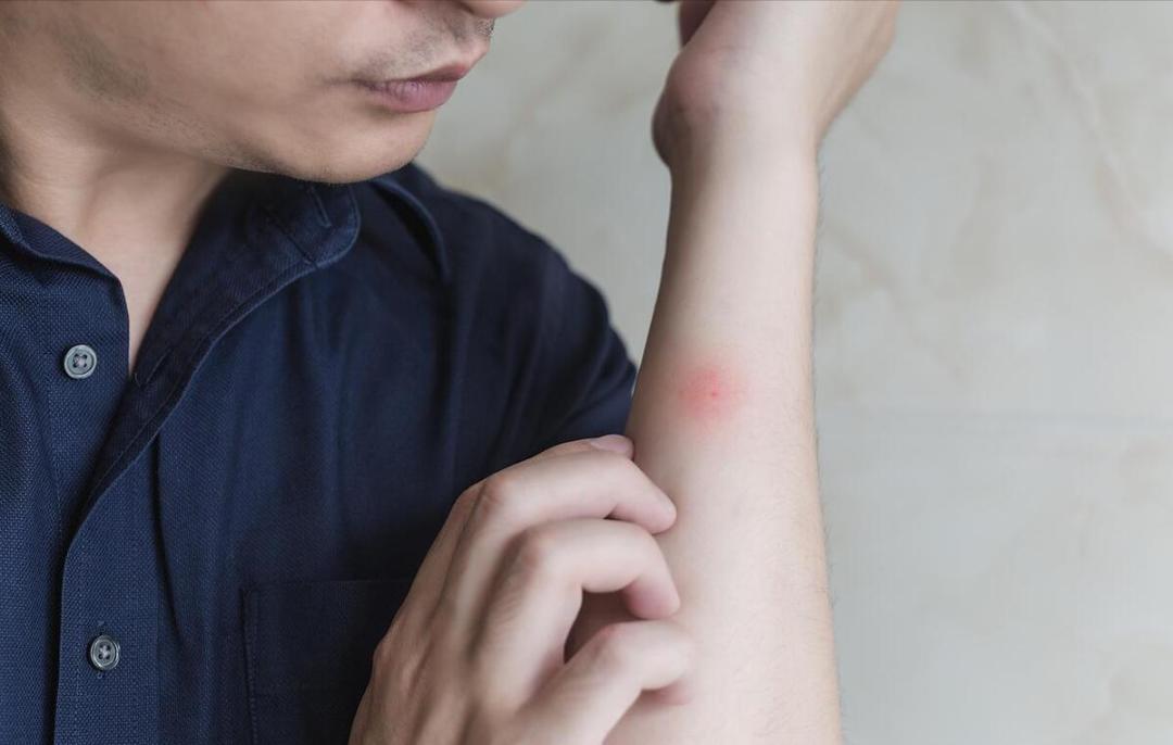 皮肤瘙痒是肝癌来临了吗,皮肤瘙痒是肝癌出问题了