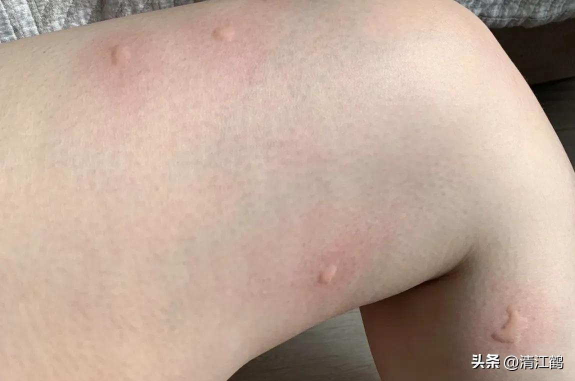 蚊香氯氟醚菊酯0.08和0.03哪个好,蚊香氯氟氰菊酯0.05和0.08哪个好