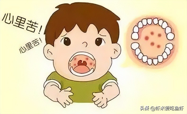 幼儿园手足口预防措施有哪些,手足口预防要两针间隔多久