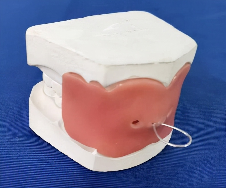 徐州儿童牙齿矫正牙齿不齐,大连口腔医院儿童牙齿矫正怎么样