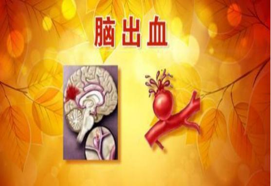 脑梗和脑出血的区别和原因,脑梗与大脑出血有什么区别