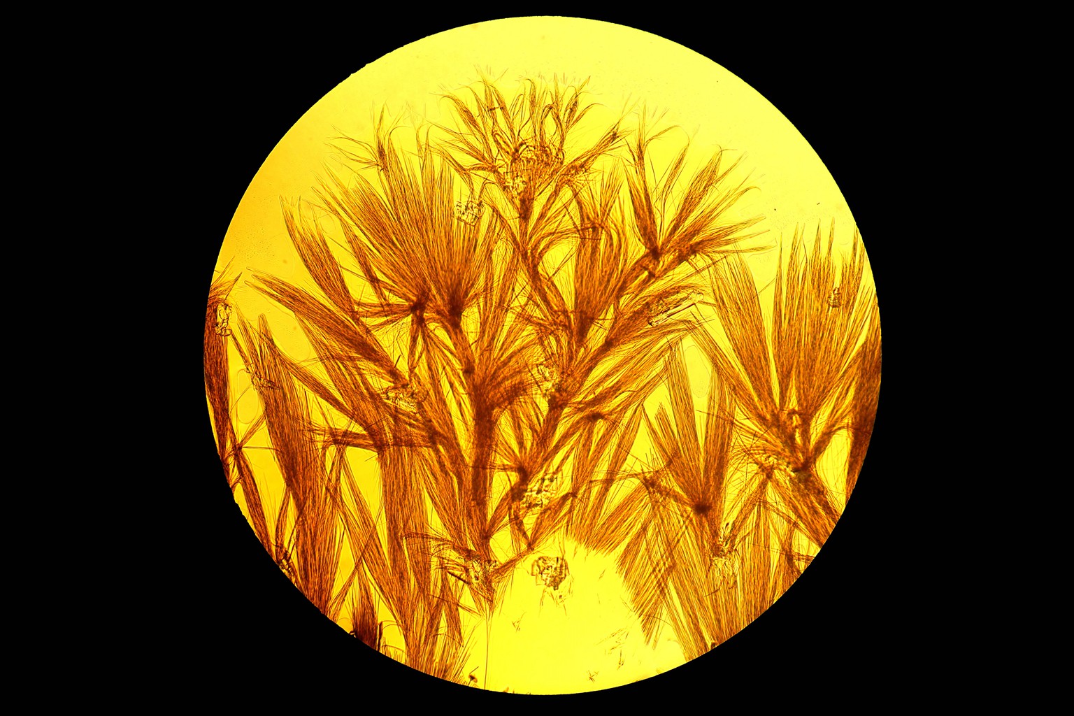 显微镜下结晶图片,显微镜下针状结晶图