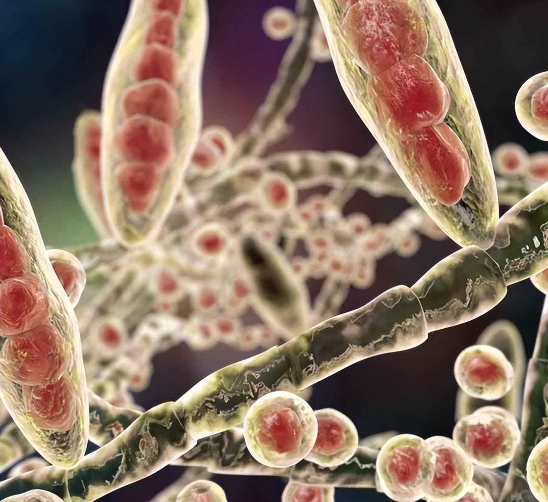 梅毒脚的典型表现!多数人却以为是得了脚气,白白耽误了病情