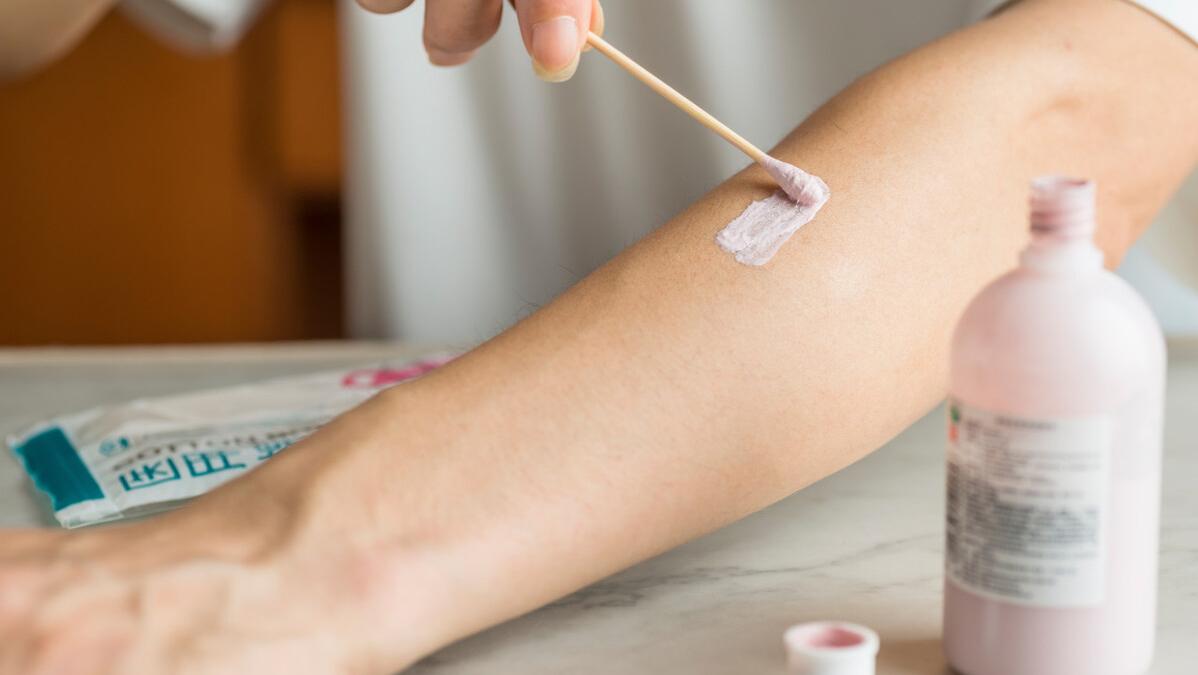 hpv感染有什么症状长湿疹,湿疹和hpv感染起的疹子一样吗