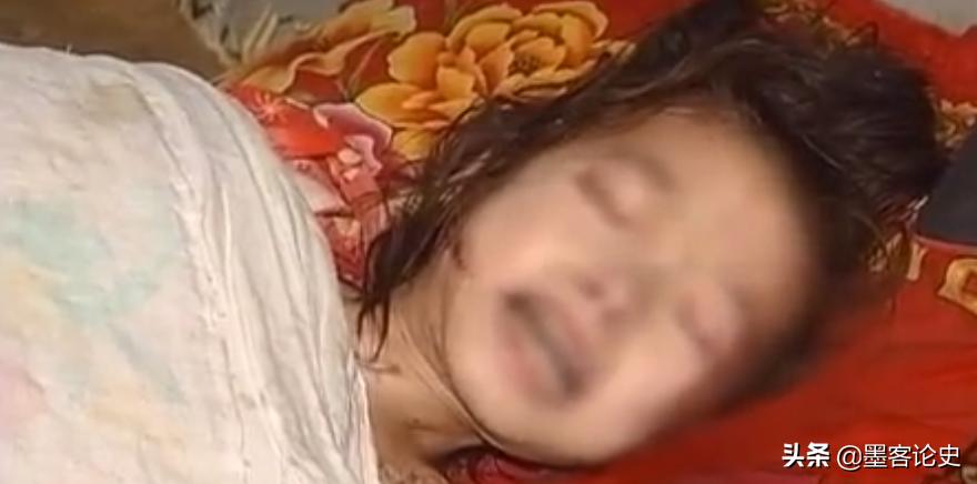 四川11岁骨结核女孩现状,四川11岁女孩骨结核