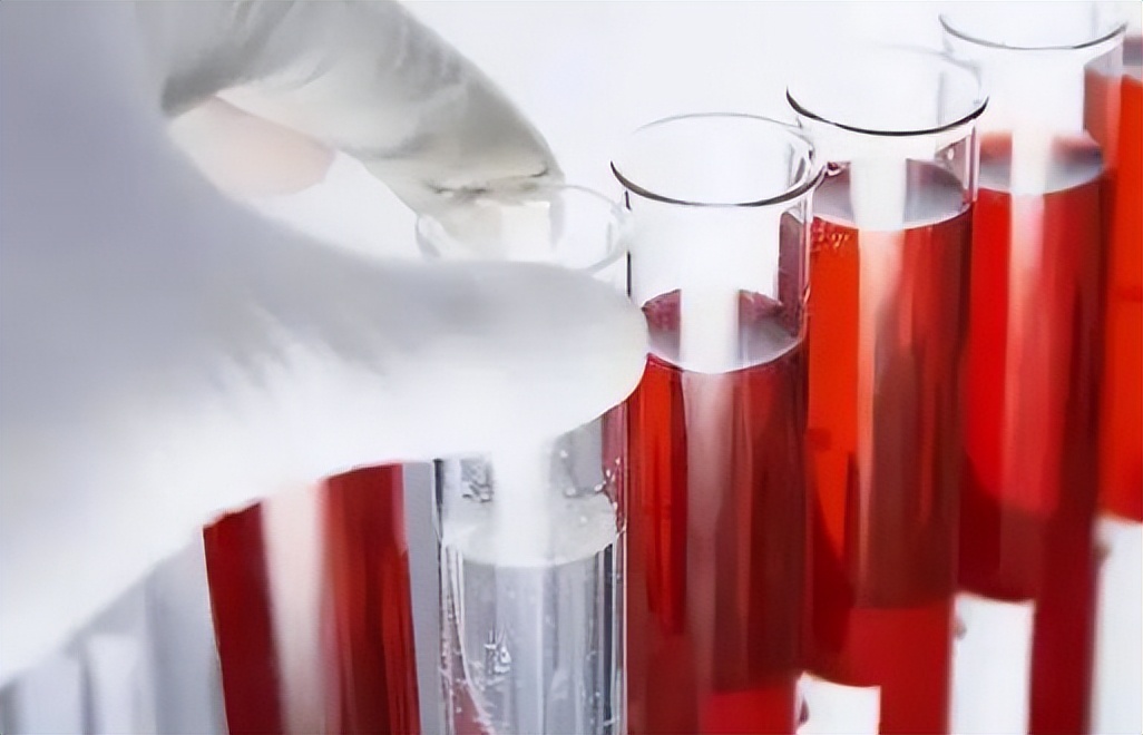 血常规最怕三种指标偏高一点点,血常规检查一些指标偏高一点点