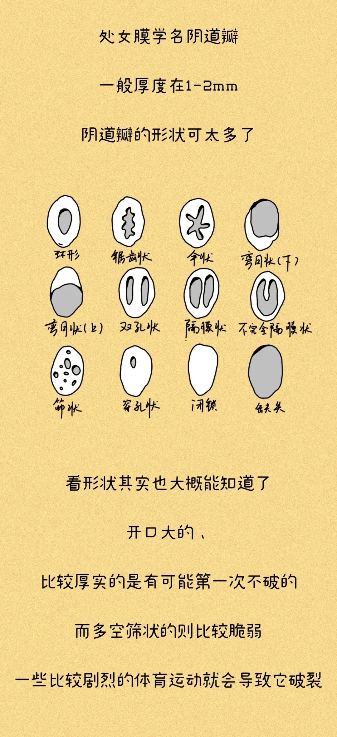 女生的处女膜，到底长什么样？